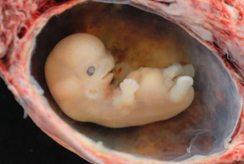 The Amniotic Sac