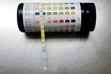 Urine testing during Pregnancy